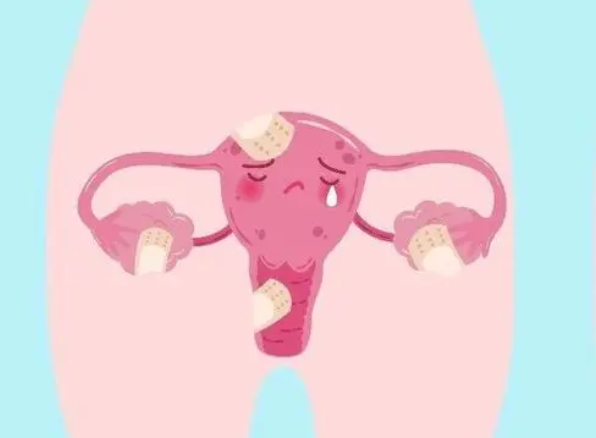 哪一代试管婴儿更适合卵巢早衰患者_卵巢早衰可以做第三代试管婴儿吗？(图1)